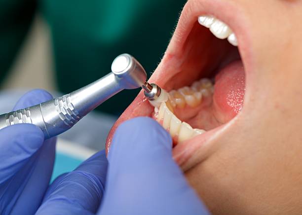 Best Root Canal Treatment  in Benton, AR